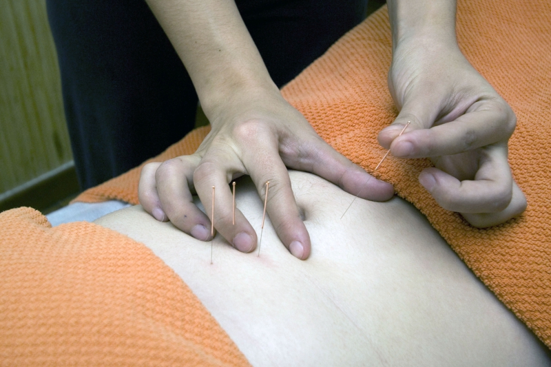 osteopathe-VALLAURIS-min_acupuncture-4175625